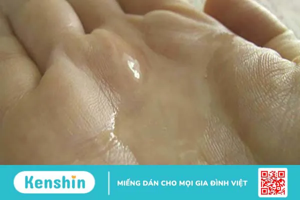 Màu tinh dịch giúp bạn nhận biết bệnh gì? Xem ngay