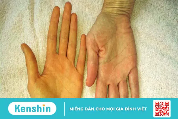 Màu tinh dịch giúp bạn nhận biết bệnh gì? Xem ngay