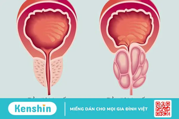 Màu tinh dịch giúp bạn nhận biết bệnh gì? Xem ngay