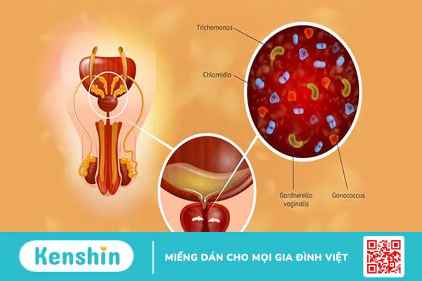 Màu tinh dịch giúp bạn nhận biết bệnh gì? Xem ngay