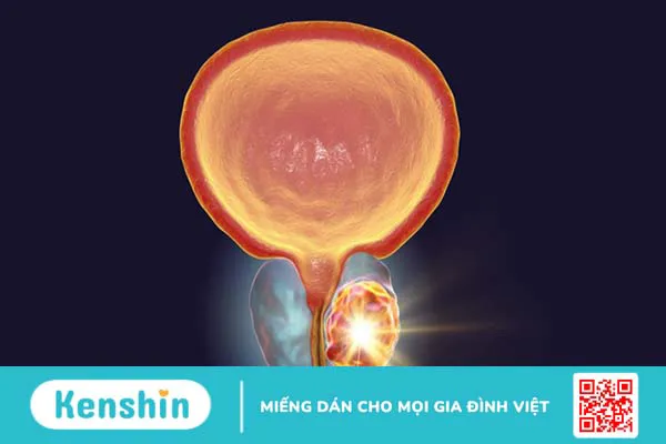 Màu tinh dịch giúp bạn nhận biết bệnh gì? Xem ngay