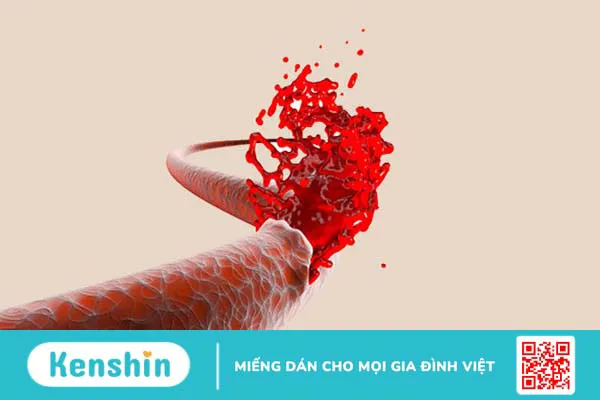 Màu tinh dịch giúp bạn nhận biết bệnh gì? Xem ngay