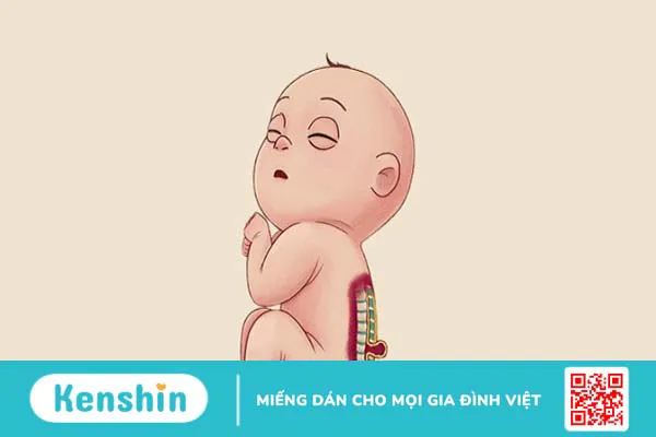 Mẹ bầu 3 tháng đầu ăn măng cụt được không? 10 lợi ích và lưu ý khi ăn