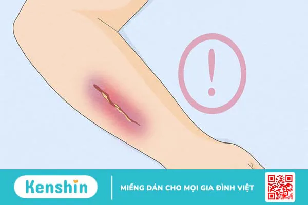 Menthol là gì? Công dụng của menthol với sức khỏe