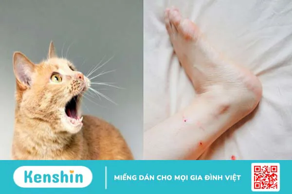 Mèo cắn, cào chảy máu có bị bệnh dại không? Cách xử lý vết thương