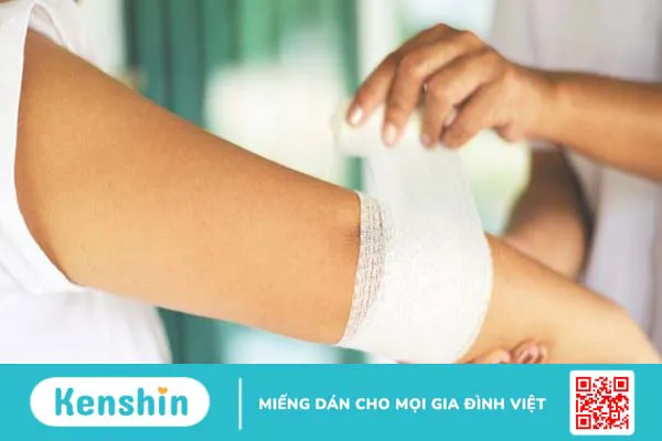 Mèo cắn, cào chảy máu có bị bệnh dại không? Cách xử lý vết thương