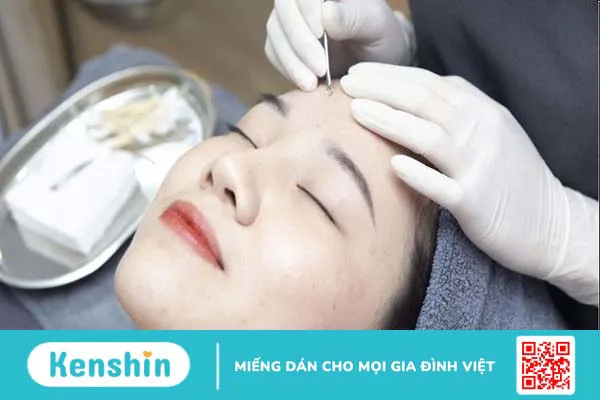 Nặn mụn xong nên làm gì để không bị thâm? Cách chăm sóc da sau nặn mụn