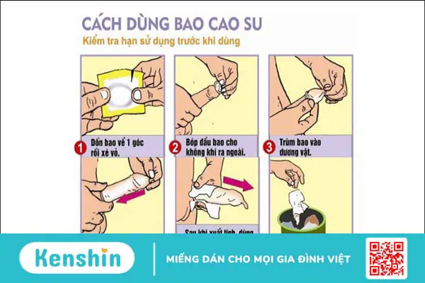 Nên đeo bao cao su lúc nào? Hướng dẫn cách đeo bao cao su an toàn