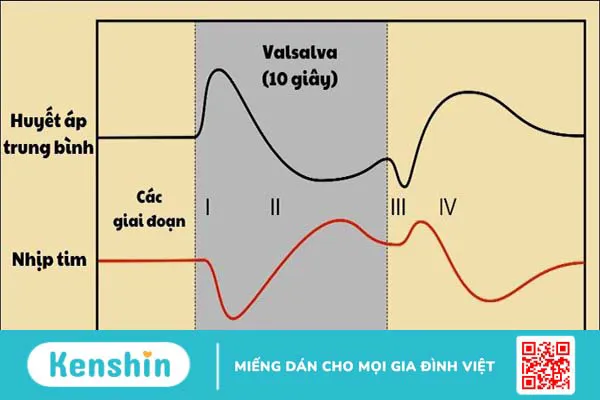 Nghiệm pháp Valsalva và các ứng dụng trong khám chữa bệnh