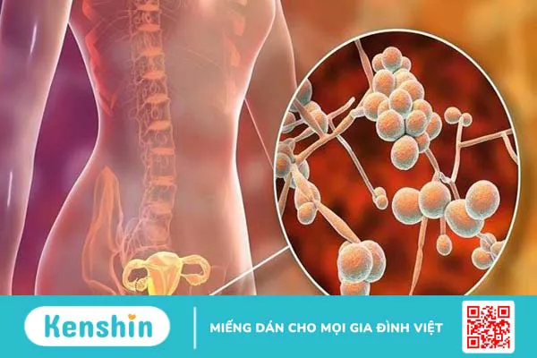 Ngứa âm đạo là bệnh gì? 8 nguyên nhân ngứa vùng kín cần biết