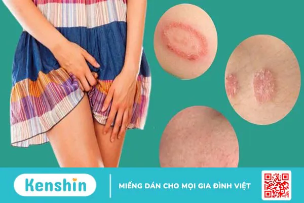 Ngứa âm đạo là bệnh gì? 8 nguyên nhân ngứa vùng kín cần biết