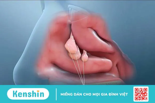 Ngứa mũi là bệnh gì? 9 nguyên nhân gây ngứa mũi bạn nên biết