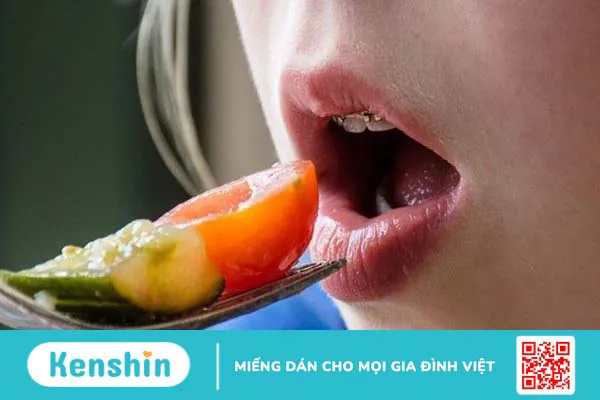 Người mới niềng răng nên ăn gì và kiêng gì? Các lưu ý trong khi niềng răng