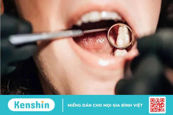 Người mới niềng răng nên ăn gì và kiêng gì? Các lưu ý trong khi niềng răng