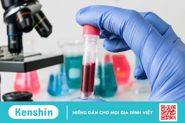 Người nhiễm giun kim sẽ bị gì? 4 dấu hiệu nhiễm giun kim bạn cần biết