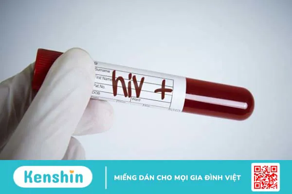 Nguy cơ nhiễm HIV từ dịch vụ làm đẹp: Cách xử lý và phòng ngừa