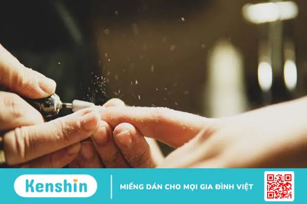 Nguy cơ nhiễm HIV từ dịch vụ làm đẹp: Cách xử lý và phòng ngừa