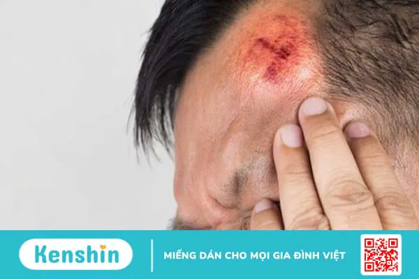 Nguyên nhân động kinh thường gặp và các yếu tố liên quan