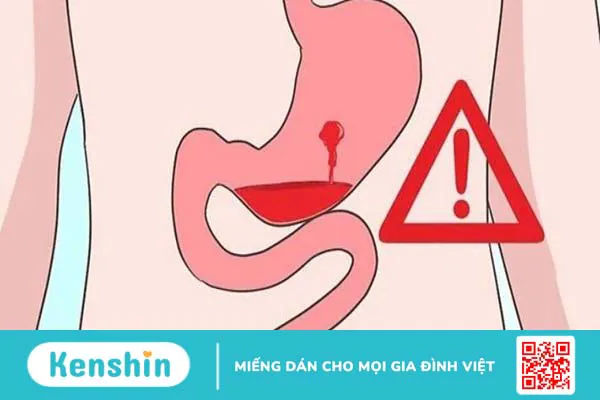 Nguyên nhân, triệu chứng, điều trị khi thiếu sắt