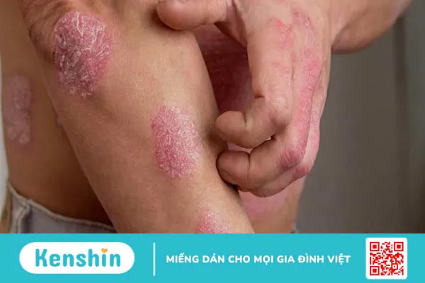 Nguyên nhân viêm bao quy đầu phổ biến có thể bạn đang gặp phải