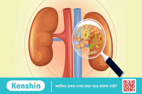 Nguyên nhân viêm đường tiết niệu có thể bạn chưa biết