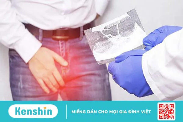 Nguyên nhân viêm tinh hoàn phái nam cần cảnh giác