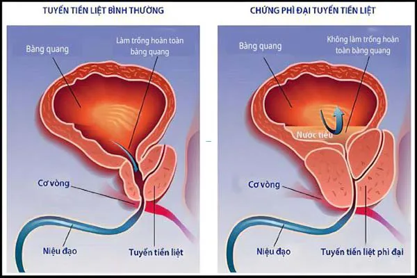 Nguyên nhân xuất tinh sớm ở nam giới có thể bạn chưa biết