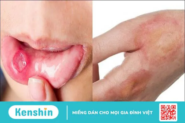 Nha đam có tác dụng gì? 11 công dụng của nha đam với sức khoẻ và da