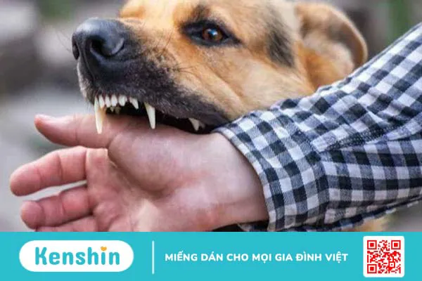 Nhận biết dấu hiệu bệnh dại theo từng giai đoạn bệnh