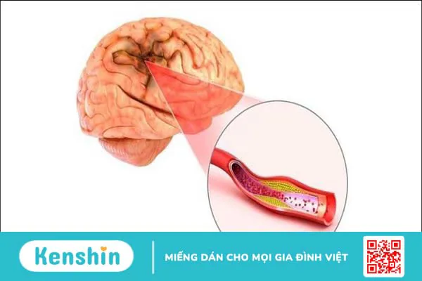 Nhân sâm có tác dụng gì? 12 tác dụng của nhân sâm đối với sức khỏe