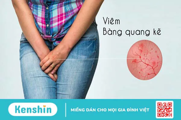 Nhịn tiểu lâu có hại như thế nào? Cảnh báo 7 tác hại của việc nhịn tiểu