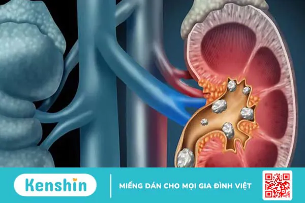 Nhịn tiểu lâu có hại như thế nào? Cảnh báo 7 tác hại của việc nhịn tiểu