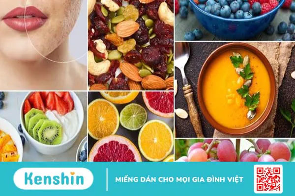 Nho bao nhiêu calo? Ăn nho có béo không? Cách ăn nho giảm cân và lưu ý