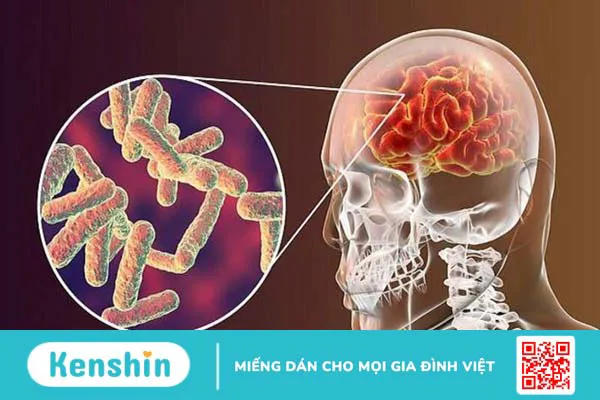 Những bệnh lây qua hôn nhau – 11 bệnh lây qua hôn nhau bạn cần lưu ý