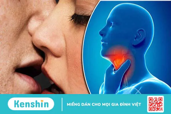 Những bệnh lây qua hôn nhau – 11 bệnh lây qua hôn nhau bạn cần lưu ý