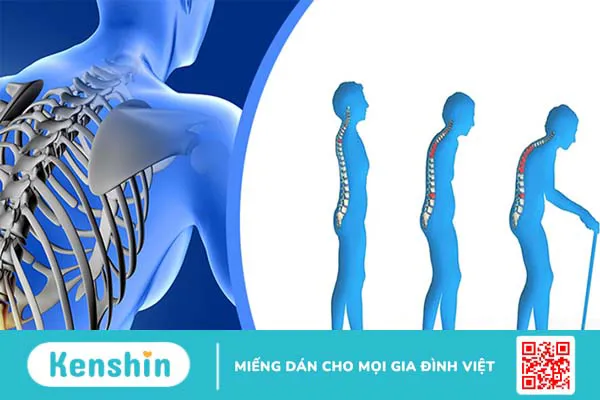 Những đối tượng không nên dùng chất xơ