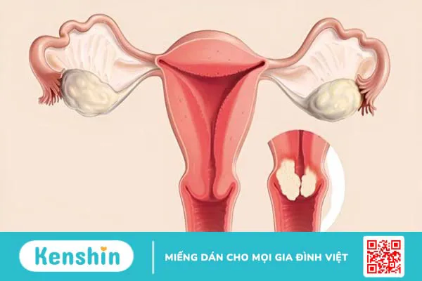 Những lợi ích của ích mẫu đối với sức khỏe phụ nữ