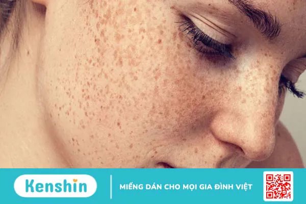 Những lợi ích tuyệt vời từ giấm táo đối với làm đẹp và chăm sóc cơ thể