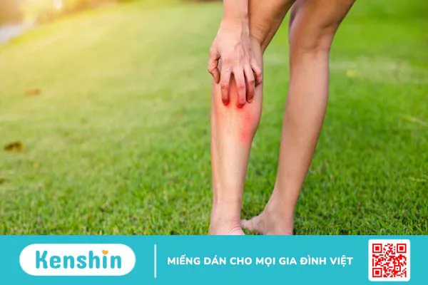 Những lợi ích tuyệt vời từ giấm táo đối với làm đẹp và chăm sóc cơ thể