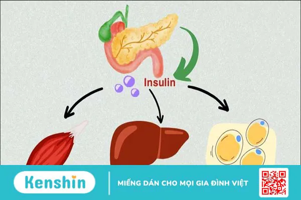 Những nguyên nhân gây bệnh tiểu đường và biến chứng cần lưu ý