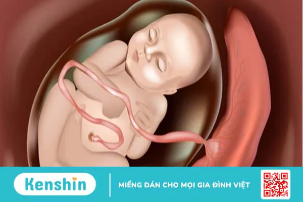 Những nguyên nhân gây bệnh tiểu đường và biến chứng cần lưu ý