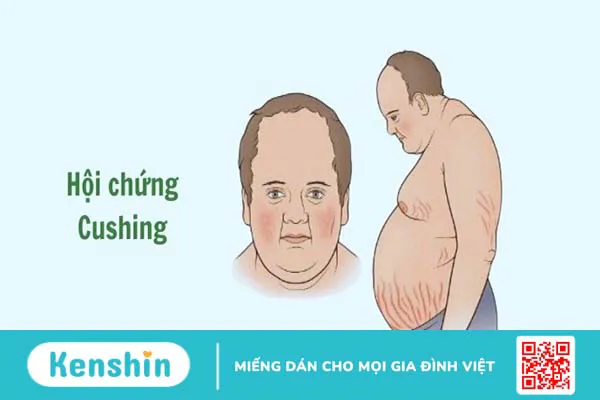 Những nguyên nhân gây bệnh tiểu đường và biến chứng cần lưu ý