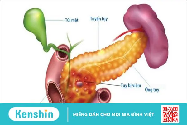 Những nguyên nhân gây bệnh tiểu đường và biến chứng cần lưu ý