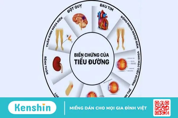 Những nguyên nhân gây bệnh tiểu đường và biến chứng cần lưu ý