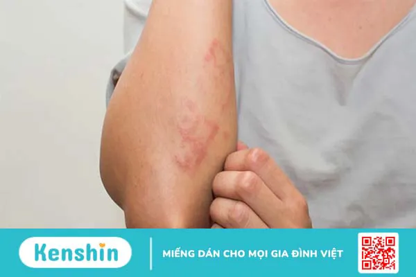 Những tác dụng tuyệt vời từ nghệ đối với chăm sóc da