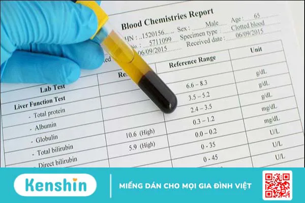 Những xét nghiệm sốt xuất huyết cho kết quả chính xác và nhanh chóng