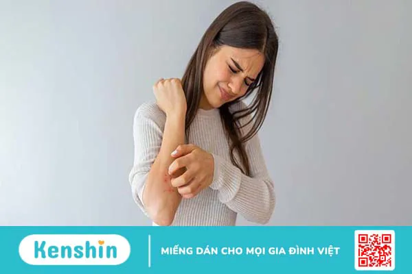 Nổi mề đay kiêng gì? Nên ăn gì và lưu ý giúp giảm ngứa, mau lành