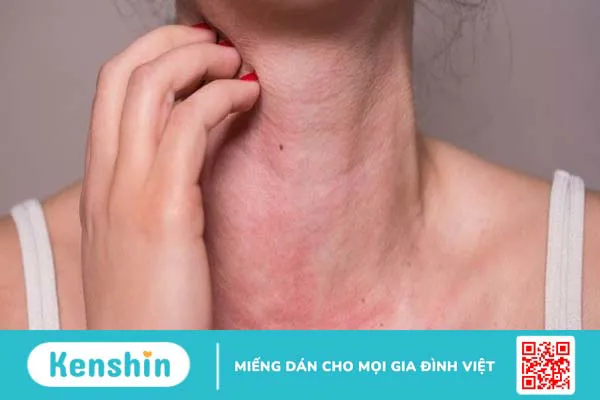 Nước dừa bao nhiêu calo? Uống nước dừa có giảm cân không?