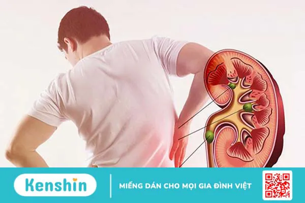 Nước tiểu đục là bệnh gì? Nguyên nhân và dấu hiệu bạn nên cảnh giác