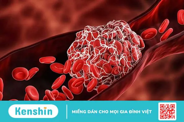 Omega 3 có tác dụng gì? 14 công dụng của Omega 3 có thể bạn chưa biết